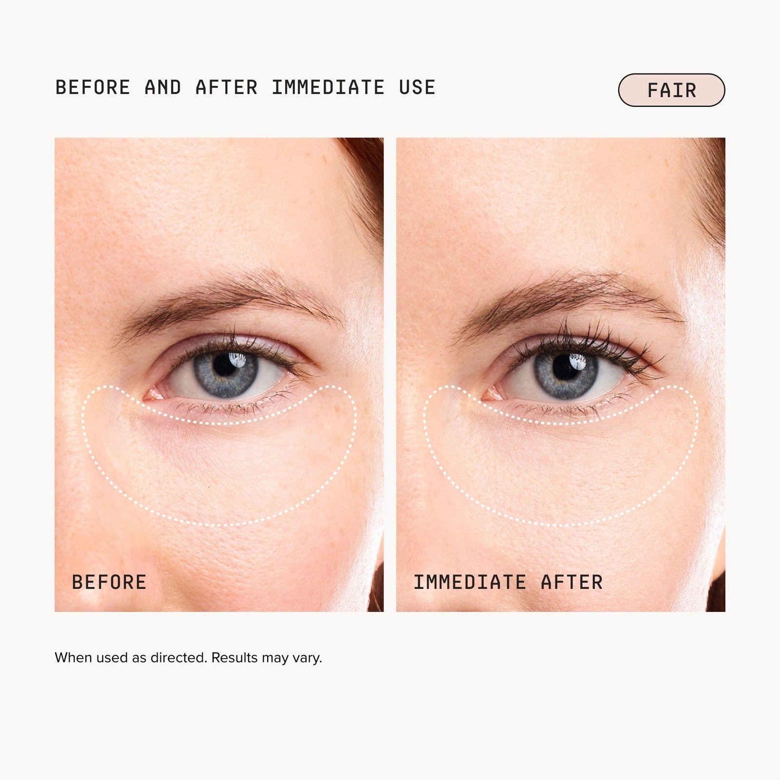 Before and after immediate use - Fair